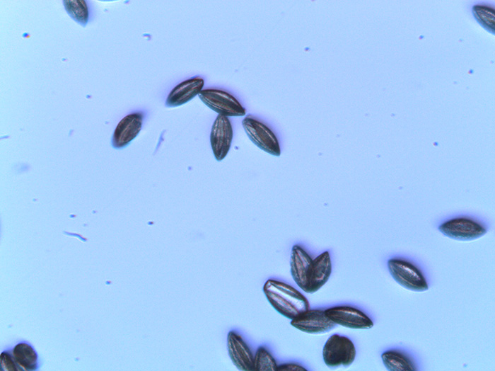 イチョウの花の観察